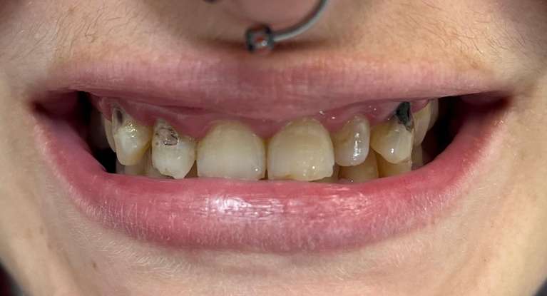 Restoration-2-Before-Image